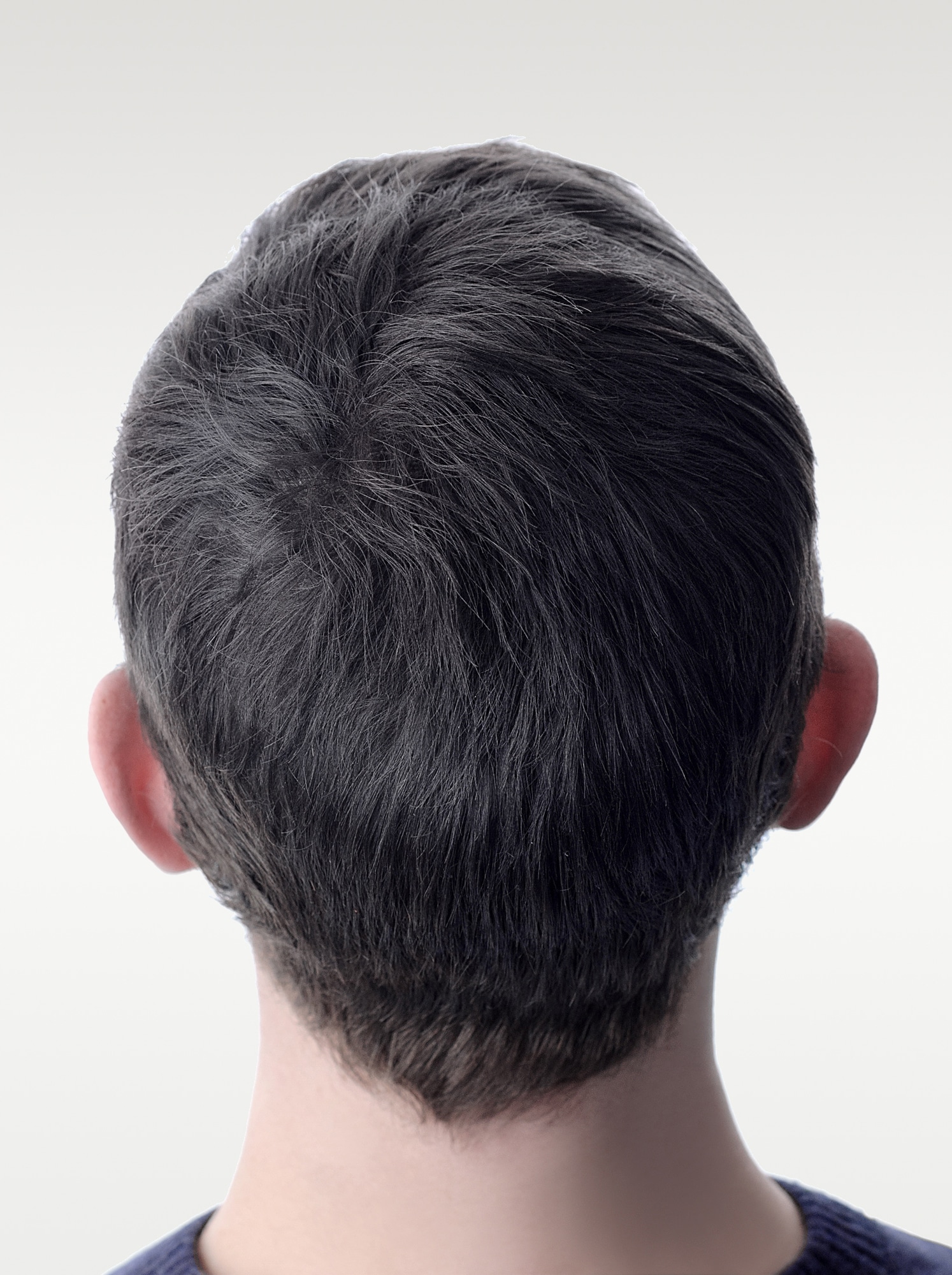 Avant et après Micropigmentation pour Homme, DPC BY FRED - Dermopigmentation Capillaire Hommes à Saint-Nazaire
