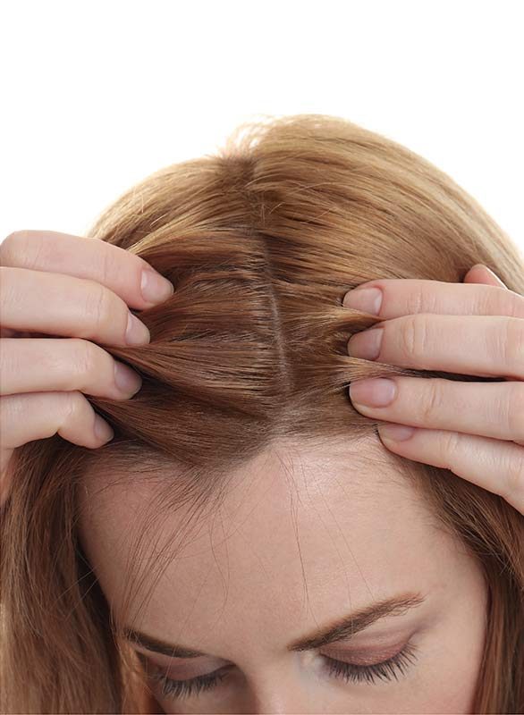 Micropigmentation pour Femme, DPC BY FRED - Dermopigmentation Capillaire à Saint-Nazaire