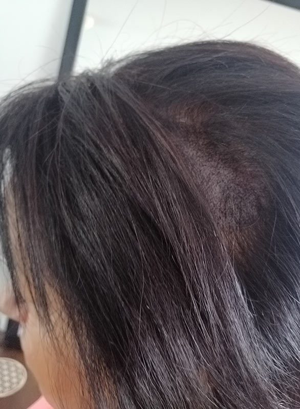 Micropigmentation pour Femme, DPC BY FRED - Dermopigmentation Capillaire à Saint-Nazaire